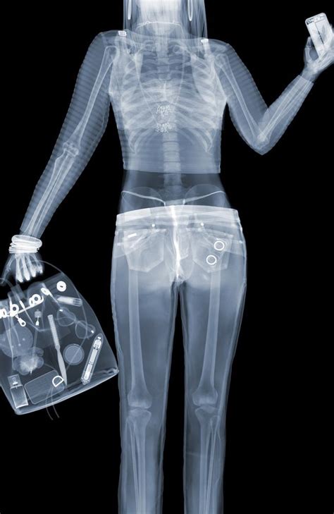 The data is only saved locally (on your computer) and never transferred to us. . Nude xrays